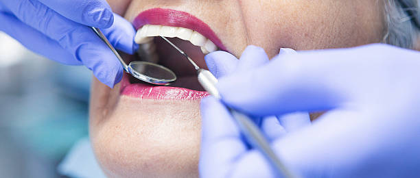 Best Emergency Denture Repair in Marshall, WI